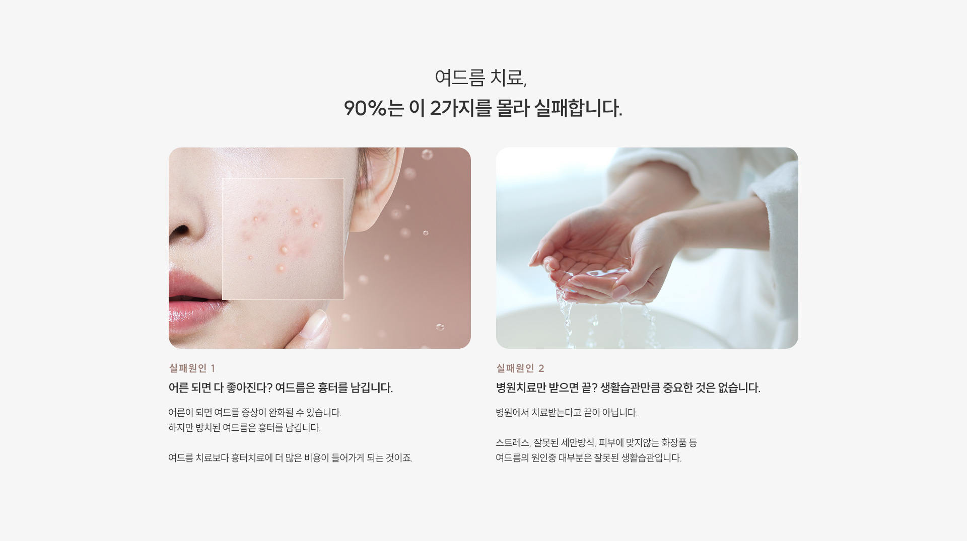 여드름/모공/흉터 제모 타이틀